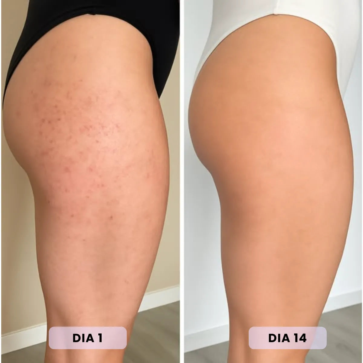Pompia™ – Antibacterial Exfoliating Towel
